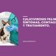 Calicivirosis felina: síntomas, contagio y tratamiento.